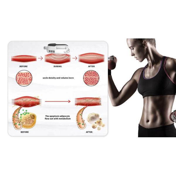 product-1200-675 Portable Ems Sculpt Slimming Machine Electric Muscle Stimulator EMS Body Shaping Sculpting Fat Burning Machine