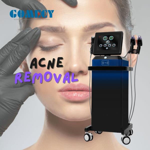 GOMECY Fractional Radiofrequency Microneedles Rf Skin Tightening Microneedling Facial Scar Removal Skin Rejuvenate