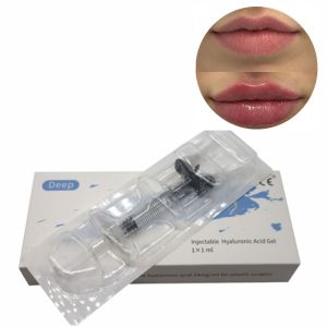 Injectable Sodium Hyaluronate Dermal Filler Cross Linked Hyaluronic Acid for