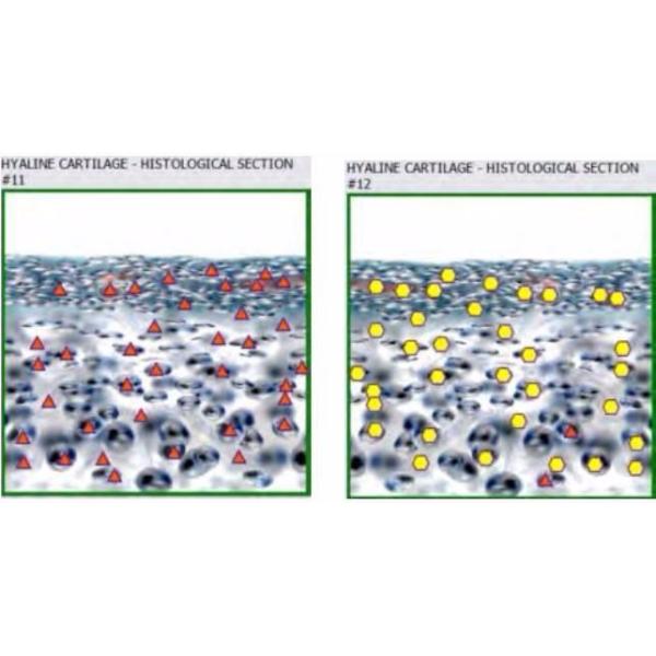 Metatron hunter 4025 with german software