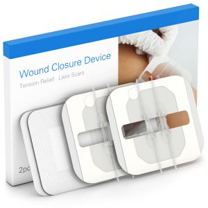PWT1002 Flexible Fabric Bandages Wound Closure Device 2PCS