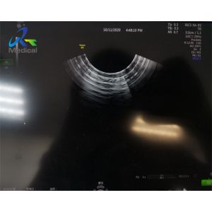 GE RIC5-9A-RS Ultrasound Transducer Crystal Array And Dome Replacement 4D And