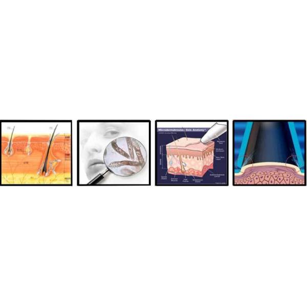 Facial Deep Cleaning Water Oxygen Jet Peel Machine / hydro Dermabrasion water oxygen jet deep skin cleaning