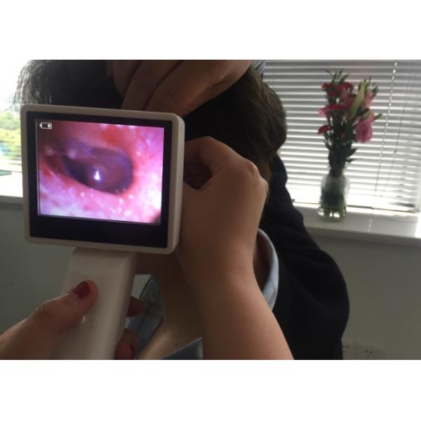 3.5 Inch LCD Digital Video Otoscope Camera For Ear Drum Perforation Inspection