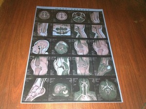 Buy Low Fog Medical X Ray Films , High Sharpness Konida X-ray Dry Film at wholesale prices