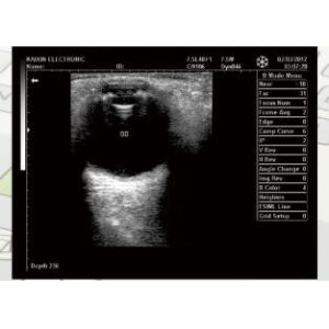 Digital Ultrasound Machine Portable Black and White Ultrasound Scanner in Four