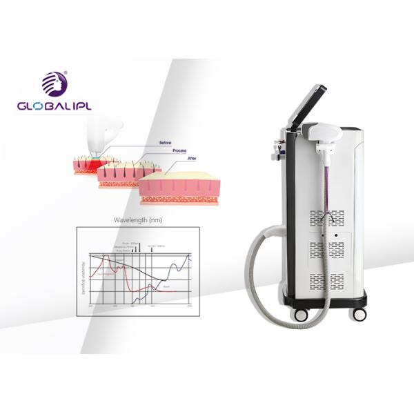 AC 220V SHR 3500W 120J/Cm2 808nm Hair Removal Equipment