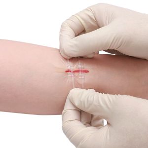 PWF1001 Flexible Fabric Bandages Wound Closure Device 2PCS