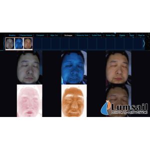 China Portable Skin Analysis Machine Skin Testing Machine For Face Enhanced / Rejuvenation on sale China Portable Skin Analysis Machine Skin Testing Machine For Face Enhanced / Rejuvenation on sale