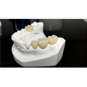 Ceramic Dental Crown,Zirconia Dental Crowns