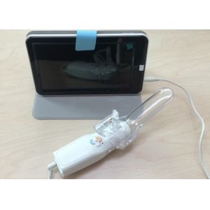 High Definition Display Digital Electronic Colposcope Portable Device to Check