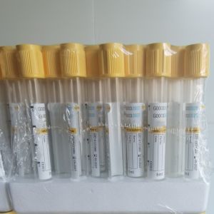 Plastic Vacuum Tube Sterile Essential for Efficient Blood Collection