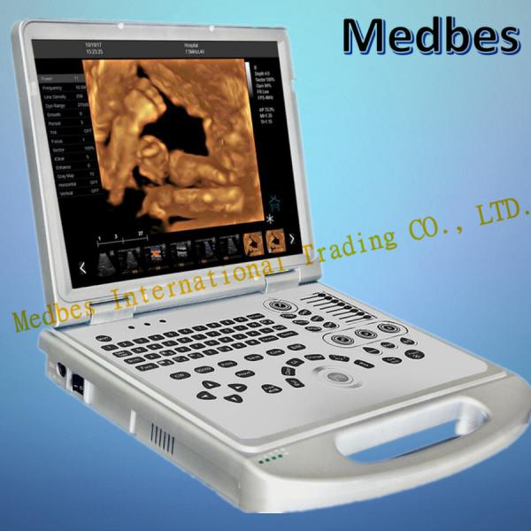 Buy 15-Inch Portable Ultrasound Scanner with Convex Probe (M-C60PLUS) at wholesale prices