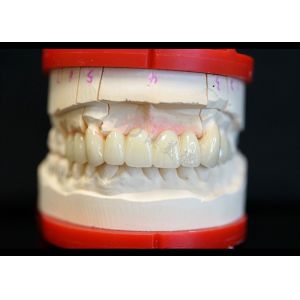 China Strength Natural Esthetics Solid Zirconia Crown Perfect Fit for Single or Multiple Teeth on sale