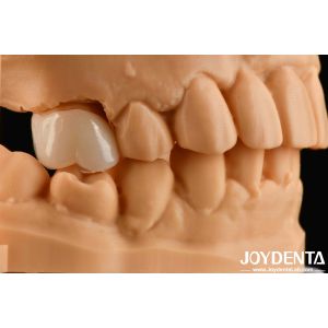 Natural-looking Esthetics With Biocompatible Dental Zirconia Winning Combination