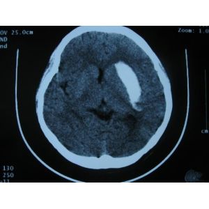 Clear Konida X Ray Dry Film , Fuji Medical Diagnostic Imaging