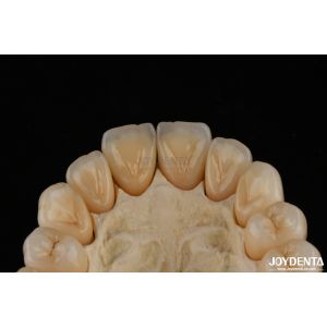 3D Multi Layer Dental Full Zirconia Chipping Resistance Natural Tooth Structure