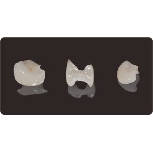 Buy cheap Accuracy Dental Inlays And Onlays Lithium Disilicate Milling Onlay Veneer from wholesalers