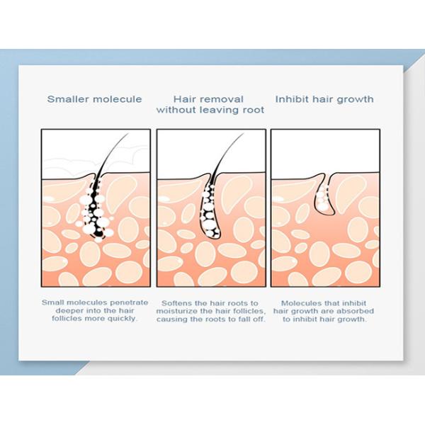 Multifunction 3 Handles SHR RF IPL Hair Removal Machine