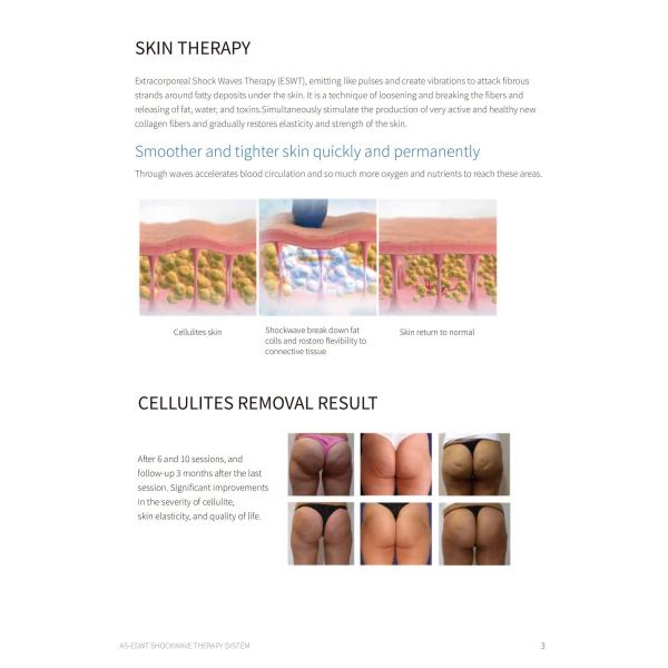 Professional Shockwave Therapy Machine For Pain Management And Injury Treatment