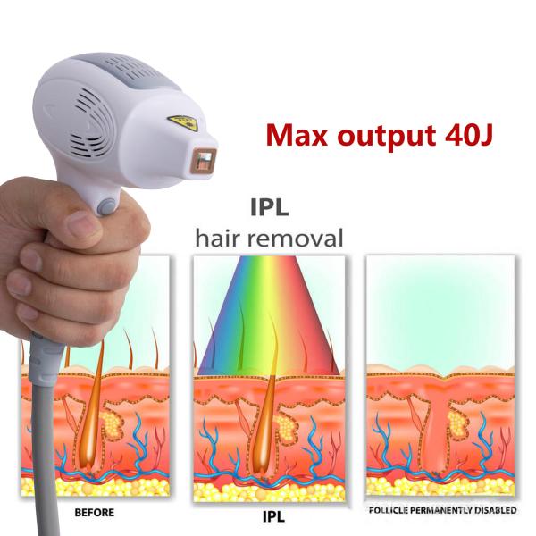 Professional Home 808 Laser Hair Removal Machine