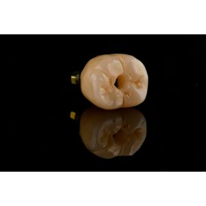 Oral Implantology Self Tapping Single Tooth Dental Implants With Internal Hex