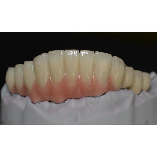 Buy Embracing Technological Advancements The Future Of Dental Implant Crowns at wholesale prices