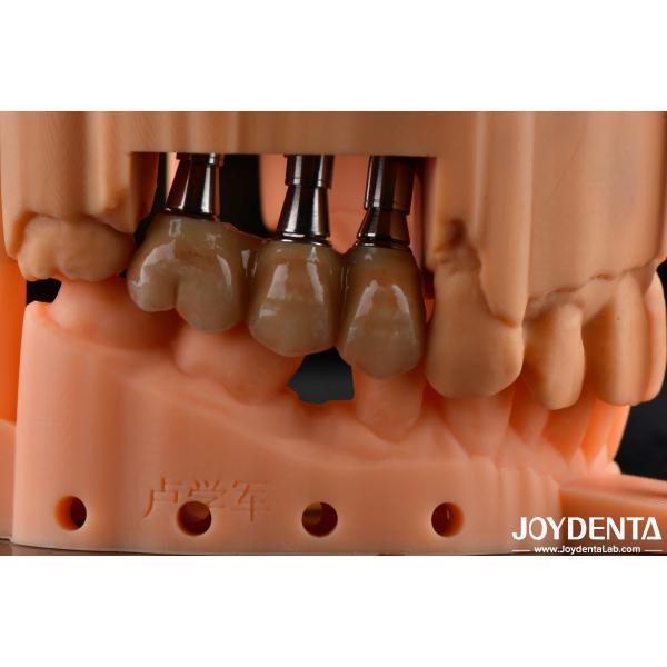 High Flexural Strength Multilayer Full Zirconia Dental Solution Full Arch