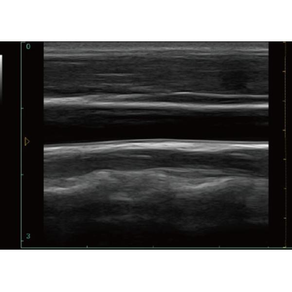 256 Frame Cine Portable Ultrasound Scanner 128 Permanent Storage With 12 Inch