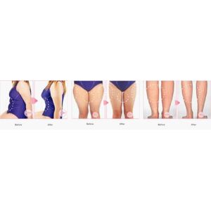 Portable No Needles Mesotharapy needle free beauty equipment machine