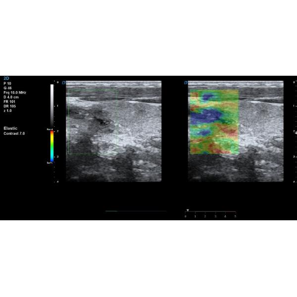 New arrival DW-T8 Elastography trolley ultrasonic scanner 4D cardiac color doppler ultrasound with TDI
