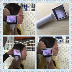 10X Magnification Ophthalmology Equipment