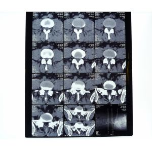 China 8in * 10in Medical Dry Transparency PET paper Film on sale