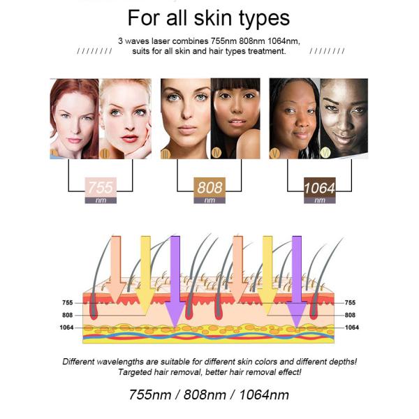 755nm 808nm 1064nm Diode Laser Hair Removal Machine 10HZ