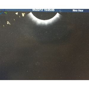 GE 8C-RS Ultrasound Transducer Probe Micro Convex Pediatric Medical