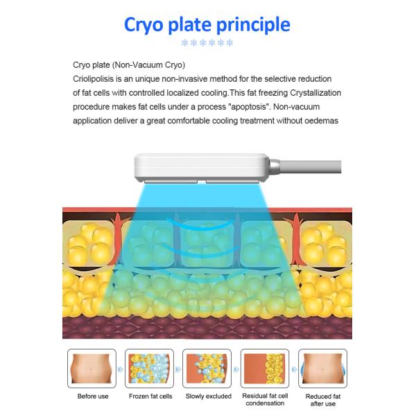 EMS Cooling Beauty Therapy Machine Fat And Cellulite Reduction Machine