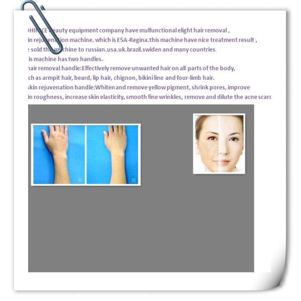 Highly Efficient E-light IPL RF , Freckle Removal Treatment Beauty Equipment