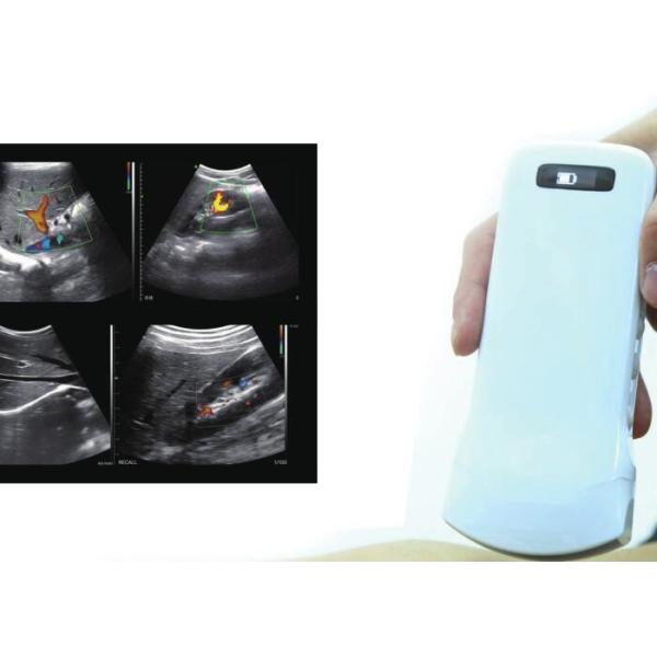 Buy Hand Held Ultrasound Wireless 10mhz Doppler Probe at wholesale prices
