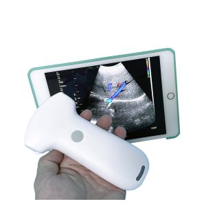 Quality Affordable Ultrasound Equipment Wireless Convex Array Medical Probe MSLPU94 for sale