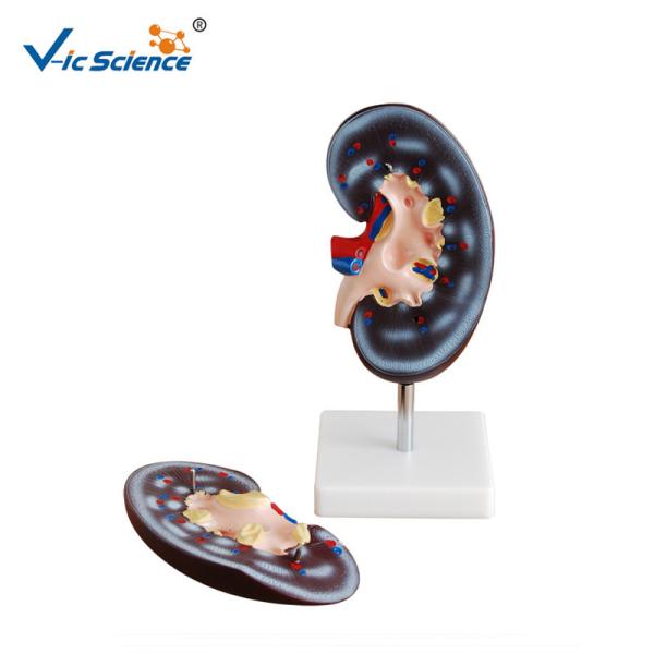 Buy Medical Science Human Body Anatomy Model Human Kidney Model 20x10x7CM at wholesale prices
