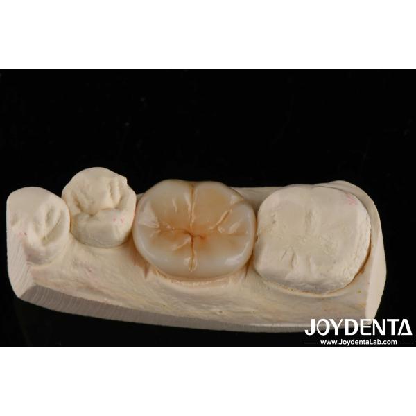 Buy 800 MPa Flexural Strength And 8 MPa·m1/2 Fracture Toughness In Multilayer Full Zirconia For Strength Applications at wholesale prices