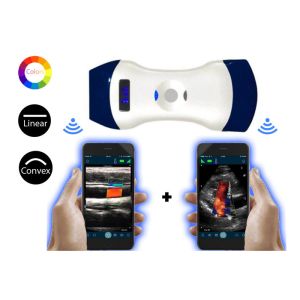 WiFi Convex Linear Ultrasound 2 in 1 Transducer Probe Color Doppler Dual Head
