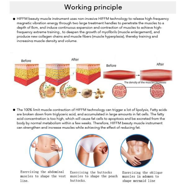 Fat Removal Cryolipolysis Fat Freeze Slimming Machine EMS Cryo Body Sculpting