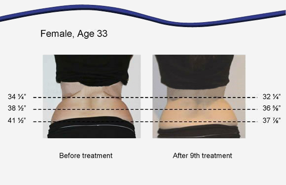 Diode Laser Multifunction Beauty Machine For Fat Reduction / Body Shaping
