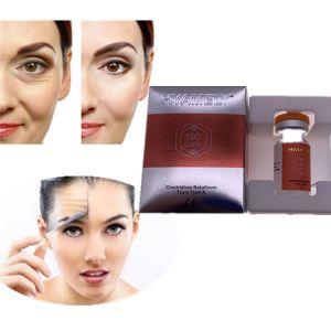 Anti Wrinkle Injection Toxin Removal Wrinkle Filler Botalux