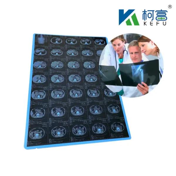 Medical X-ray Film Blue PET Based X Ray Thermal / Inkjet Film Medical Images For Clinic And Hospitals
