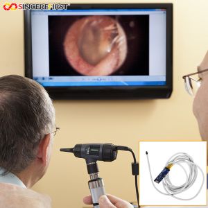 5mm 1080p 60fps Otoscope Ear Camera Endoscope Endoscopy Camera Module