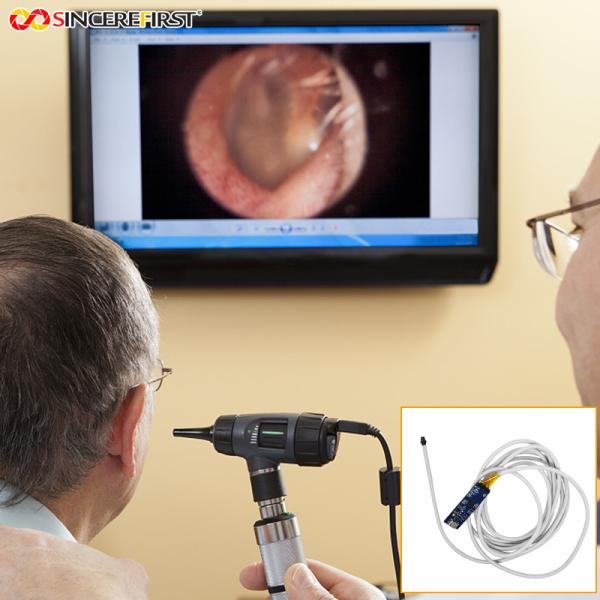Buy 5mm 1080p 60fps Otoscope Ear Camera Endoscope Endoscopy Camera Module at wholesale prices