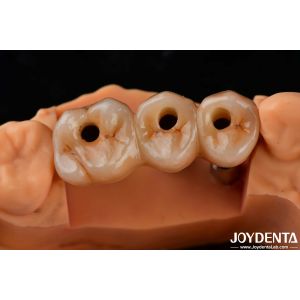 High Flexural Strength Multilayer Full Zirconia Dental Solution Full Arch