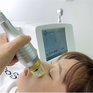 Body Collagen Induction 220V Microneedling Fractional RF